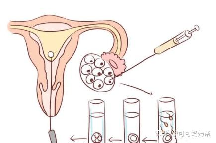 女同伴侣借卵代怀